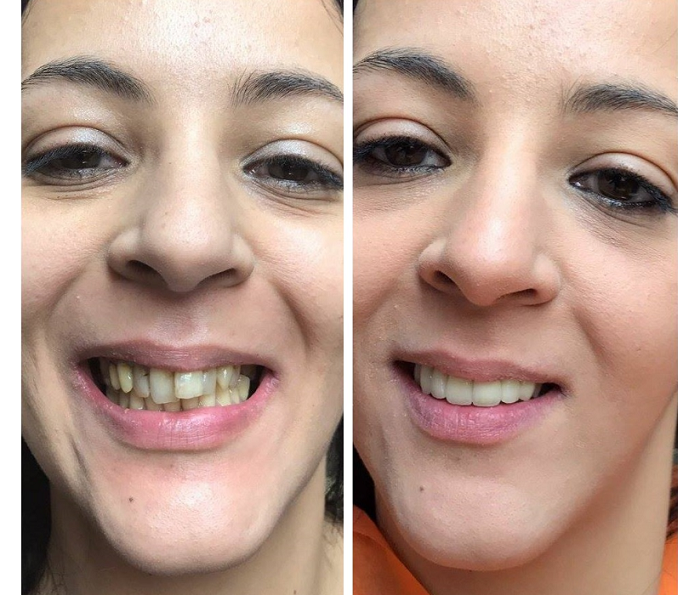 500 pcs Serviette dentaire jetable bavoirs dentaires bavoirs patients  dentaires pour patient Serviette médicale mouchoir jetable - Cdiscount